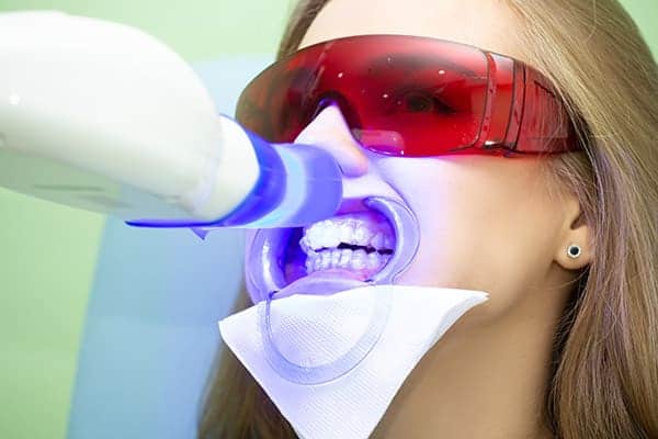 Laser teeth whitening treatments England