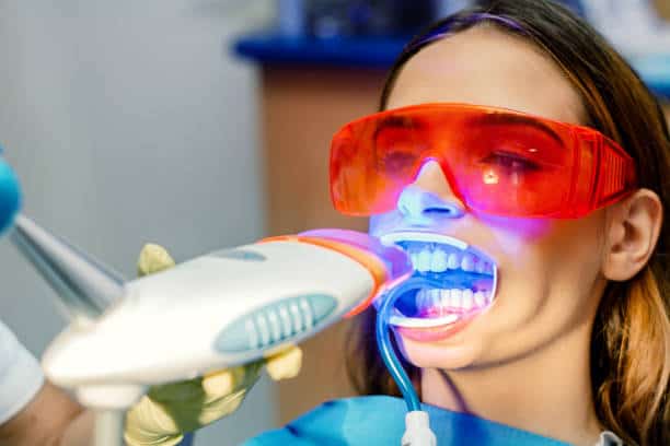 Simplifying Teeth Whitening: A Comprehensive Guide England