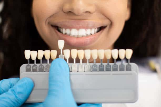 Laser Teeth Whitening: Exploring the Longevity of Your Brighter Smile England