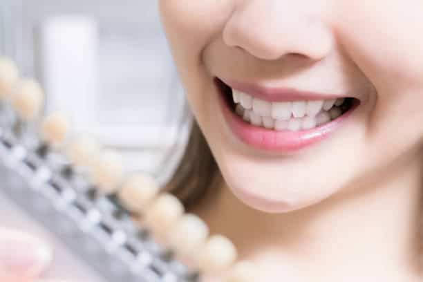 Teeth Whitening Kings Norton England