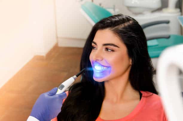 Top Teeth Whitening Systems for a Brighter Smile England