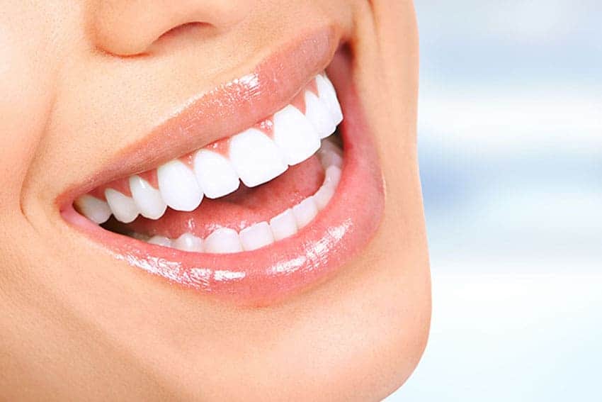 Teeth Whitening Abingdon England