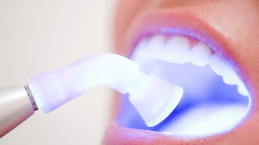 Teeth Whitening Aylesbury England