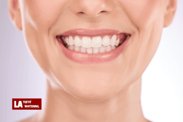 How much professional teeth whitening England