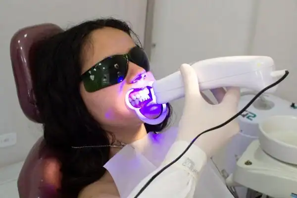 What Affects the Cost of Teeth Whitening Treatments England