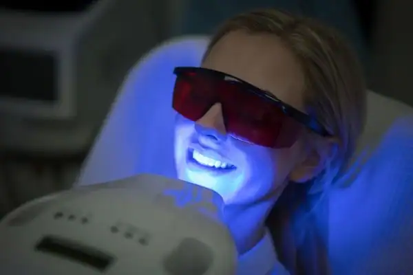 Can I Get Teeth Whitening Done at Home in England